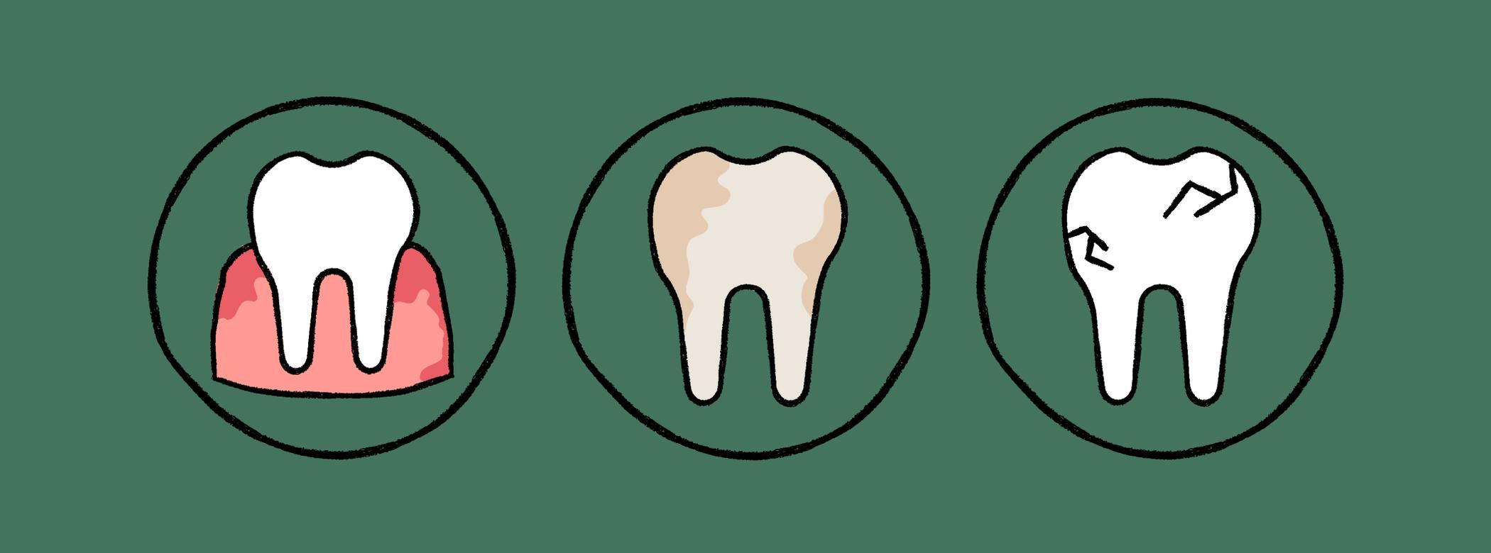 The image shows three circles, each depicting a tooth with a different condition:  Inflamed gums, Discoloration, and Cracks